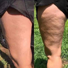 Load image into Gallery viewer, Cellulite cream