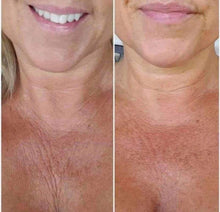 Load image into Gallery viewer, Cellulite cream
