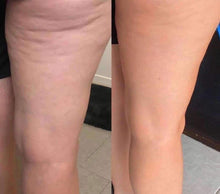 Load image into Gallery viewer, Cellulite cream