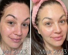 Load image into Gallery viewer, Vitamin C + collagen serum